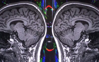 New Insights Into the Adolescent Brain