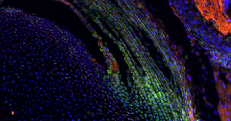 close-up images of shoulder tissue