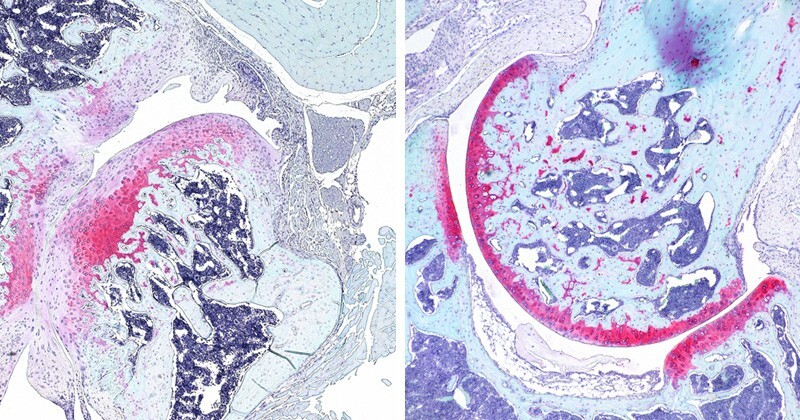 Microsopic images show a hip joint.