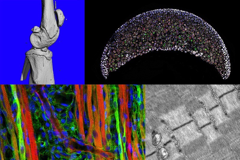 The mechanics and biology of the musculoskeletal system are inextricably intertwined, affecting each other across multiple scales, from the joint to the molecule, as illustrated here. Top, from left to right: MicroCT and histological images of knee joint and femur cartilage. Bottom, from left to right: Fluorescence image of skeletal muscle and electron micrograph of sarcomeres, the fundamental units of a muscle.
