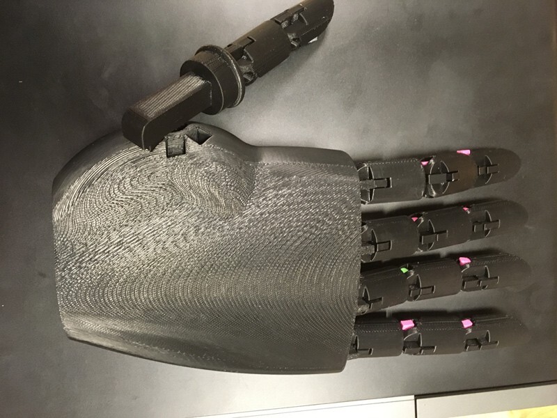 A black, 3D-printed prosthetic hand for children