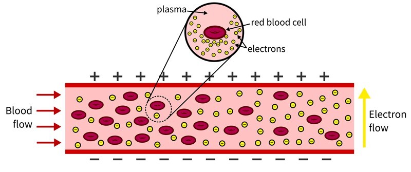 This diagram depicts the way conductivity will change as blood cells break. The yellow dots represent electrons. The red circles represent blood cells. Viewing the graphic from left to right, one can see that when more blood cells are present, fewer electrons are able to get across. As blood cells break, there are fewer barriers and the blood becomes more conductive, making it easier for electrons to move from one side to the other.