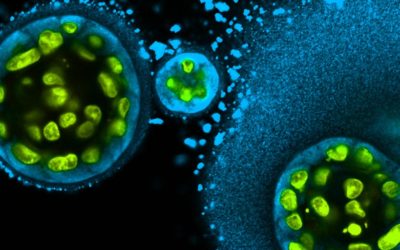 NIH Director’s Blog Feature