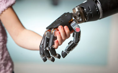 Better Prosthetic Now Within Reach