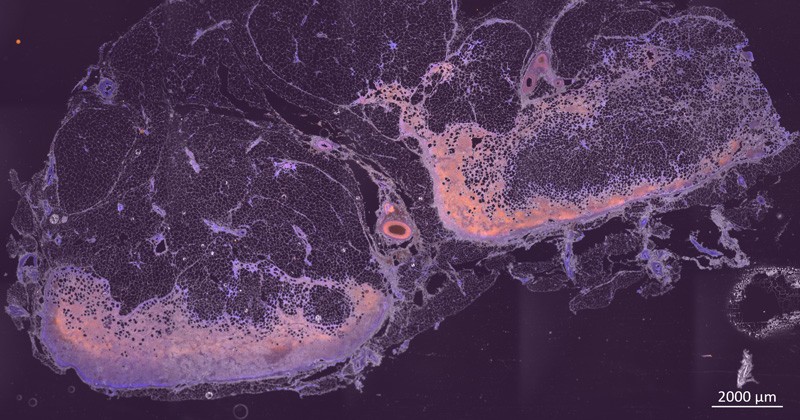 UD researchers captured images of cells inside the lymph node with a fluorescence microscope. This image, taken at 20x magnification, shows cell nuclei (blue) and a T cell marker CD3 (orange). T cells are a kind of white blood cells in the body that attack infected cells.
