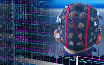 Decoding epilepsy in brain waves